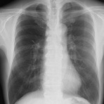 こどもの病気・おとなの病気