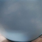 IDDM  58歳、ある日突然１型糖尿病になりました。が…