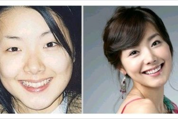 優れた ソイヒョン 整形 前 画像 壁紙新しい囲碁