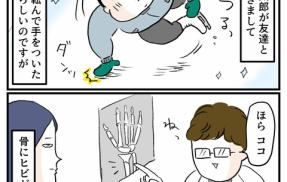 はじめての骨折