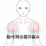 『バスの荷物積み下ろしでズキンと痛む両肩の痛み　登別室蘭すのさき鍼灸整骨院　症例報告』の画像