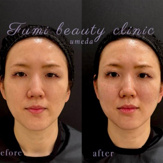 ～Dr.Fumiの美容Blog～