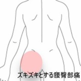 『転倒後の腰臀部のズキズキ痛で歩行困難　登別室蘭すのさき鍼灸整骨院　症例報告』の画像