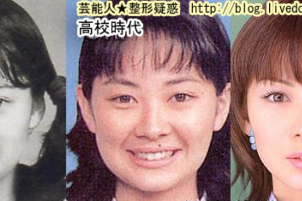 芸能人整形疑惑 あいこランラン