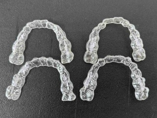 小3   マウスピース矯正開始から9ヶ月の様子