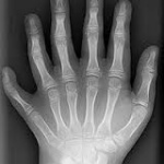 福島で多指症の赤ちゃんが激増の模様、ある病院で手術待ちなんと絶望の100人超え！　ただしソースは・・・