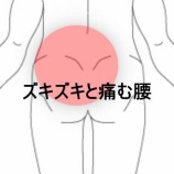 『朝起きると腰が伸ばせず前かがみになる急性腰痛 　登別室蘭すのさき鍼灸整骨院　症例報告』の画像