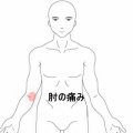 物を持つと痛む右肘内側上顆付近の痛み 　登別室蘭すのさき鍼灸整骨院　症例報告