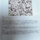 検査結果がでました