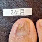 『クリアストロングショット アルファ』体験談フォーラム