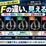 【1記事3分】超音波検査士けんしんのエコーノート