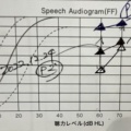 補聴器の調整にこだわりたい方へワンポイント