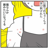 虫刺されと子供たちのハートフルストーリー