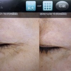 茨城県ひたちなか市伊藤医院 皮膚科・美容皮膚科のblog