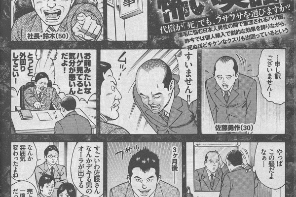 薄毛 ハゲ Agaプロペシア通販体験情報 とにかく髪を生やすために