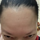 【画像あり】俺はハゲなのか？