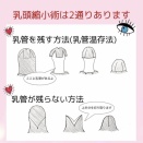 乳頭縮小術どんな手術？