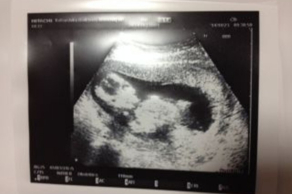 妊娠 出産 子育て 30代から幸せになるんだもん 妊娠４か月