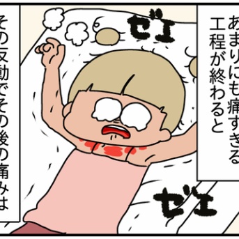 人生で一番火傷した話-11-