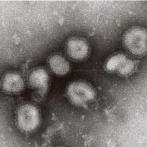 東京、あの病気が感染拡大！大丈夫かこれ！？