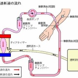 『腎不全・透析とは難病？』の画像