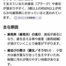 歯の事で一点。の事。