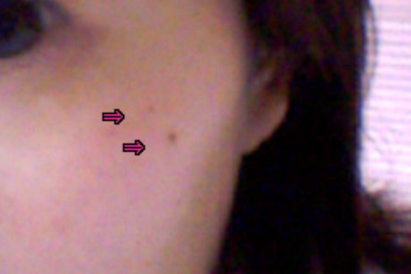 薬用シミ対策液 しほのまろまろにっき