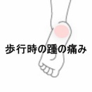 触れるだけで痛む左踵の歩行時痛