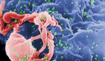 【原因不明】ロシアの主要なウイルス研究所が爆発 HIV、エボラ、炭疽菌、天然痘など貯蔵