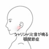 『顎のシャリシャリ音と開口障害、頸のコリ 登別室蘭すのさき鍼灸整骨院　症例報告』の画像