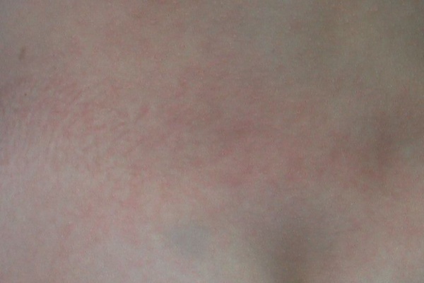 こどもの病気 おとなの病気