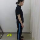Mさんの姿勢矯正