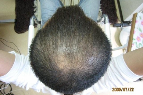 髪生やし隊小隊長の一日