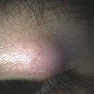 ある奈良県の眼科医が目について書いたブログ