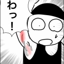 ミラドライ受けてみた③