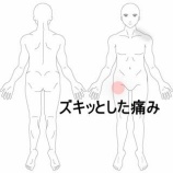 『歩行時にズキッとする股関節前側の痛み　登別室蘭すのさき鍼灸整骨院　症例報告』の画像