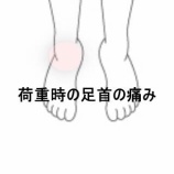 『左踵痛から右足首痛へ移行した立ち仕事後の症状 登別室蘭すのさき鍼灸整骨院 症例報告 』の画像