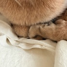 免疫力落ちた？蕁麻疹でて痒い߹-߹