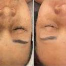 これぞ白玉水光フェイシャル！！！