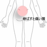 『座位から立ち上がる時に悪化する急性腰痛 　登別室蘭すのさき鍼灸整骨院　症例報告』の画像