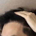 ９ヶ月経過