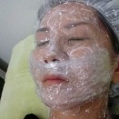 【写真あり】毛穴・クレーター治療のリアル記録