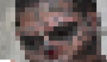 【閲覧注意】髑髏になりたくて鼻を削ぎ落とした身体改造男がヤバすぎる(動画あり)