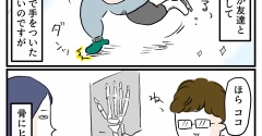 はじめての骨折