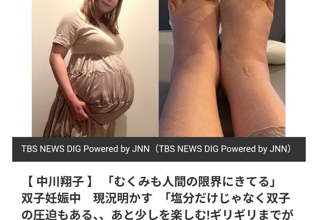 【画像】中川翔子さん、足もパンパンに「むくみもひどくて人間の限界にきてる」