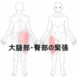 『立位時に右脚外側と臀部に強い緊張を感じる腰痛 　登別室蘭すのさき鍼灸整骨院　症例報告』の画像