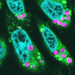 将来、光合成をするヒトは誕生するのか？葉緑体を動物細胞に移植し光合成の初期反応を確認