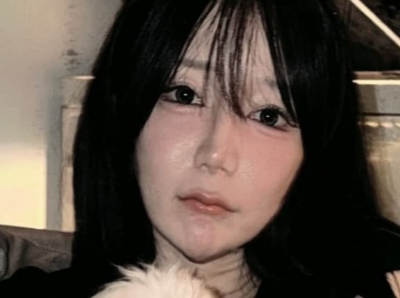  "月曜から夜更かし"の多田さん「韓国整形から3ヶ月。未だに口と顎の感覚が無い」