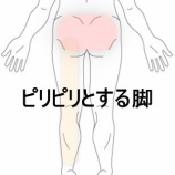 『腰部から左大腿部裏側にかけてのピリピリとした痛みと痺れ　 登別室蘭すのさき鍼灸整骨院　症例報告』の画像