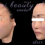 ～Dr.Fumiの美容Blog～